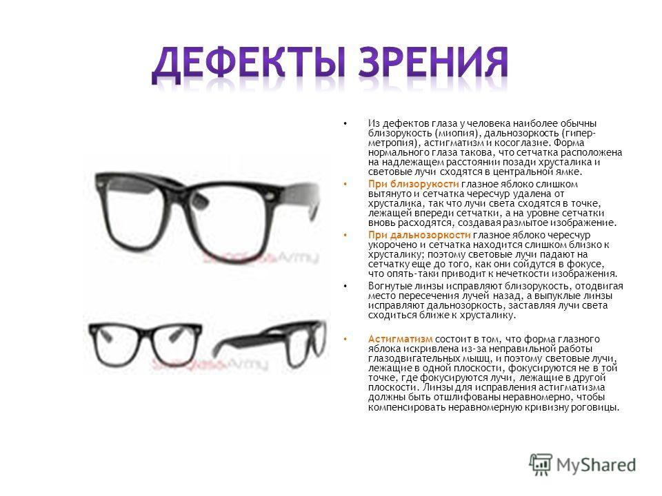 Диоптрия в очках что это. Описание очков. Дефекты зрения очки. Рекомендации по ношению очков для зрения. Очки для зрения описания.